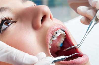 Invisalign, Palmieri Orthodontics